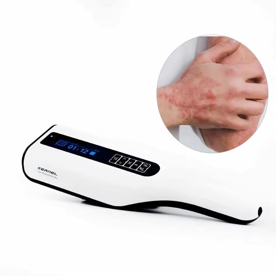 Kernel UVB Lichttherapie Handlamp – Philips™ 311nm UVB Lamp – Voor Psoriasis, Vitiligo & Eczeem – Met Timer & UV-Beschermbril – Thuisgebruik - Oplaadbaar met Accu